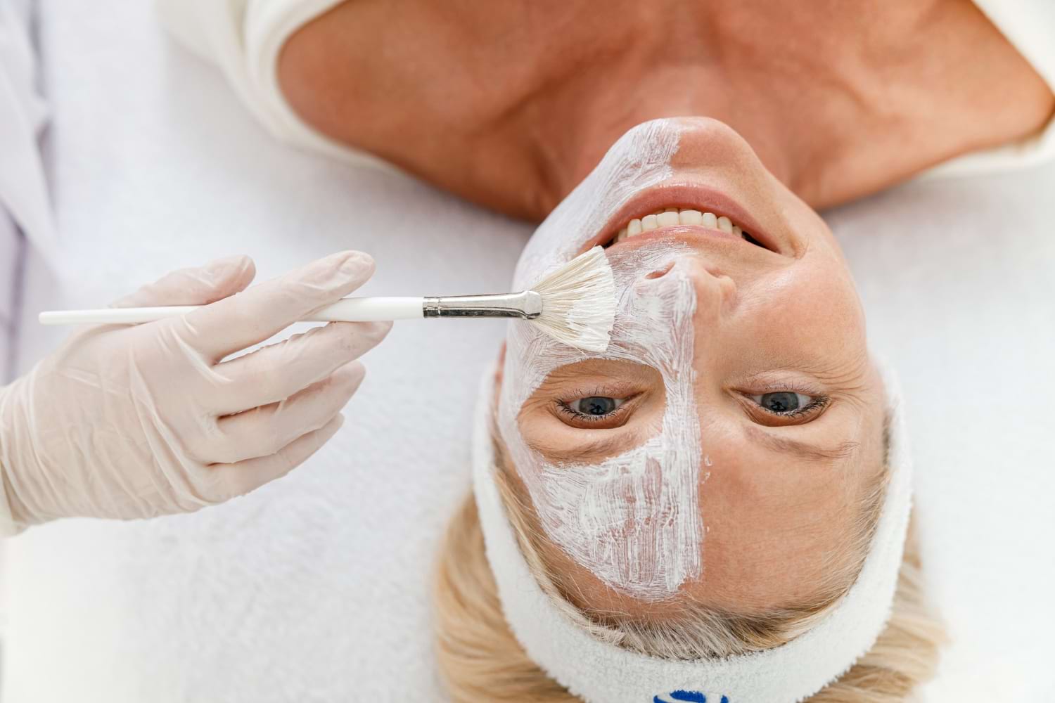 peeling chemiczny katowice